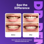 DRDENT Purple Teeth Whitening Strips - 7/21 Whitening Sessions - Non Sensitive Teeth Whitening - Peroxide-Free